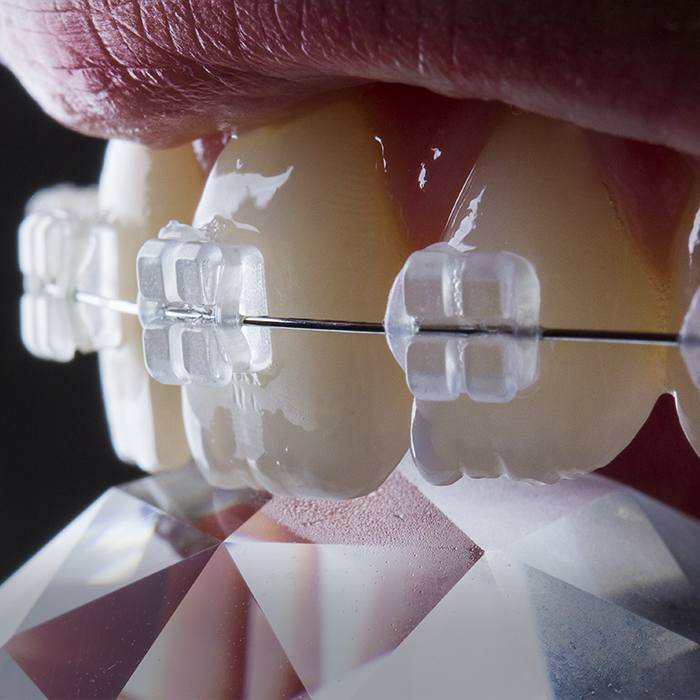 Treatment - West Bridge Dental
