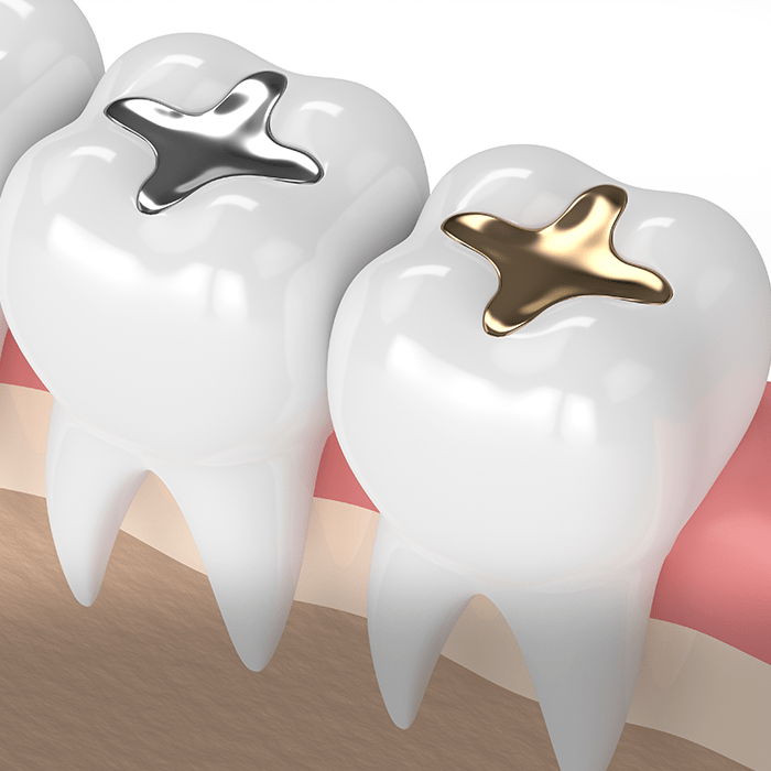 Treatment - West Bridge Dental